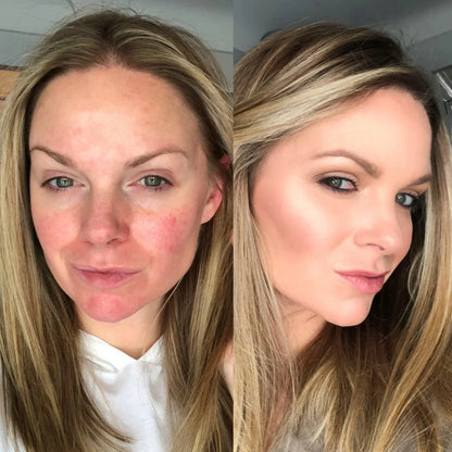 SkinFuse™ | Hybrid 4 en 1 Base Facial | Cubre, protege y dura 12 horas seguidas